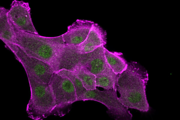 Fluorescent micrograph displays multiple magenta cells with distinct green nuclei, appearing irregularly shaped and clustered on a black background.