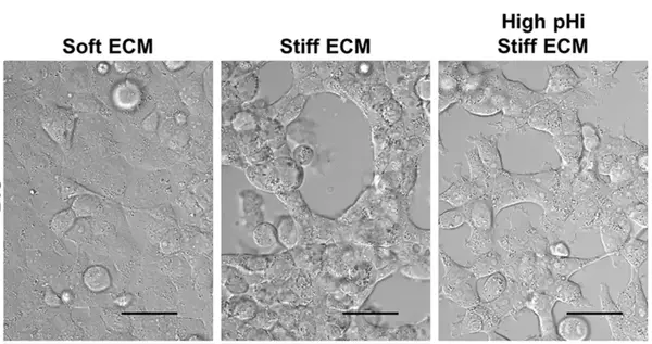 Microscopic cell views: Soft ECM shows spread cells; Stiff ECM has clustered cells with large voids; High pHi Stiff ECM shows textured, spread cells.